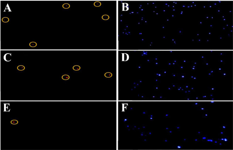 Figure 4. Detection of DNA fragmentation using the TUNEL assay with fluorescence microscopy. Sperm cells stained with DAPI (blue) were counted first, followed by cells that emitted red fluorescence (TUNEL-positive, highlighted with yellow circles); (