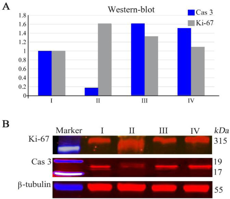 Figure 3. Western blotting of Ki-67 and caspase-3 (Cas 3) proteins in the testes of the control and experimental groups. Three testicular tissue samples from each group were pooled and subjected to western blotting. Ki-67 and caspase-3 expression in