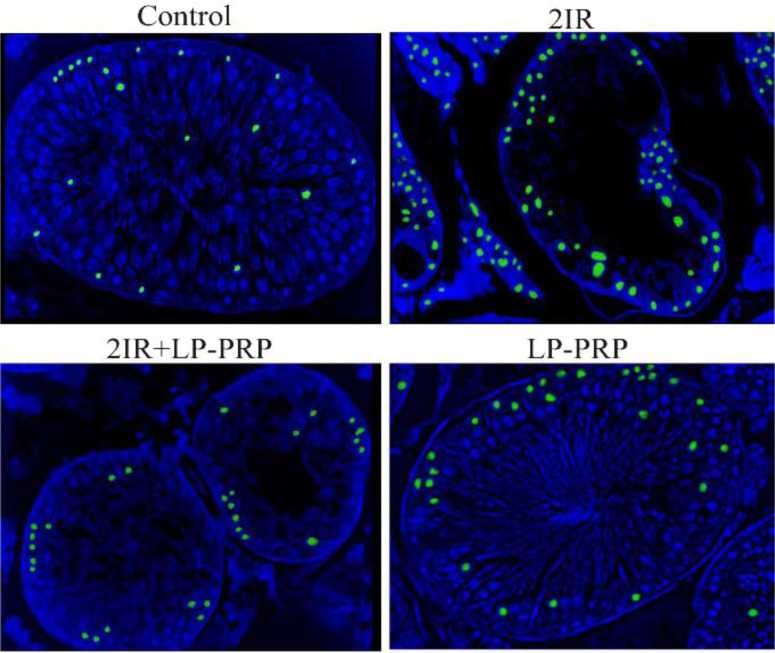 Figure 4. TUNEL and confocal microscopy of the testes on the 84th day. The luminescence was observed mainly in the basal compartment of the tubules and in the Leydig cells. Magnification ×400
