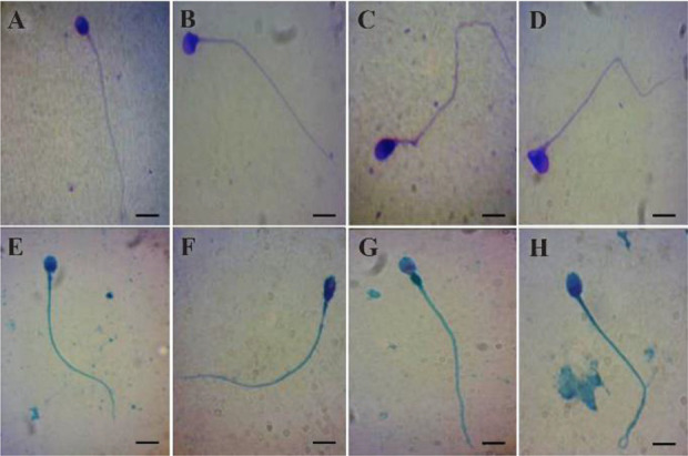 Figure 1. Spermatozoa stained with Diff-Quick (A–D) or Spermac (E–H). Representative photomicrographs showing normal spermatozoa (A and E), defect in the head (B and F), defect in the midpiece (C and G), and defect in the tail (D and H). Bar = 5 mm
