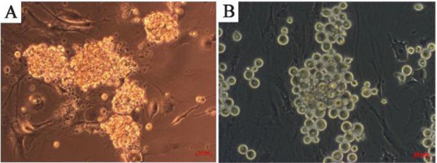 Figure 4. Differentiated (A) and undifferentiated (B) spermatogonia in bright field (scale bar 50 μm)