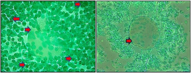 Figure 1. Comparison of Cdk 1 expression images in the oocyte. (Left) control group (T0); (Right) treatment group (T1). The red arrow indicates the presence of Cdk 1 expression in oocytes characterized by brown chromogen in the cytoplasm and cell nuc