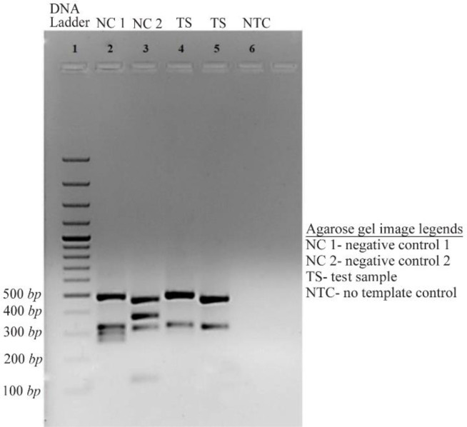 Figure 3. Agarose gel (1.8%) image of Y chromosome microdeletion analysis by multiplex PCR Lane 1: DNA ladder (100 bp). Lane 2: Negative control for ZFY-495 bp, SY84 (326 bp) [AZFa locus], SY134 (301 bp) [AZFb locus], SY127 (274 bp) [AZFb locus]. Lan