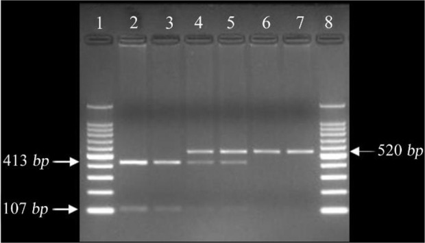 Figure 1. Gel image showing FSHR G2039A polymorphism Lane 1: 100 bp ladder, lanes 2 and 3: GG genotype (wild type) at 413/107 bp, lanes 4 and 5: GA genotype (heterozygous) at 520/413/107 bp, lanes 6 and 7: AA genotype (mutant) at 520 bp, and lane 8: