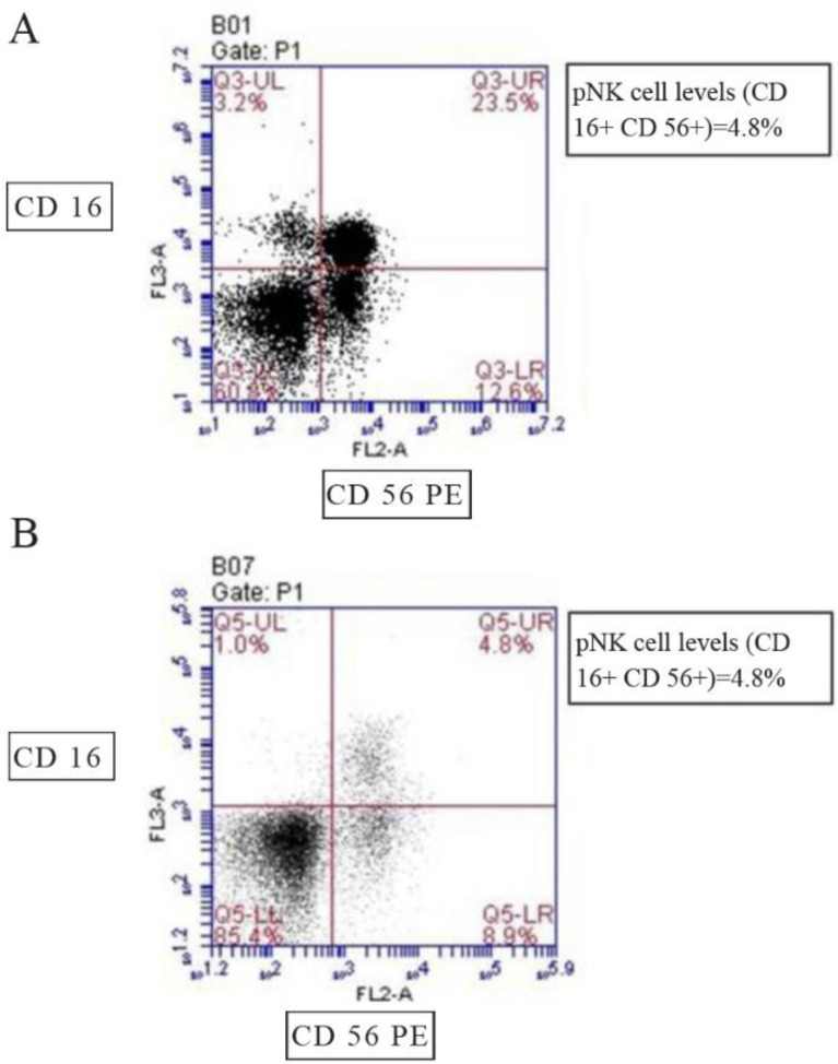 Figure 4. A) Flow cytometry dot plots showing pNK cell levels (CD 16+ CD 56+) in RIF subjects and B) control population