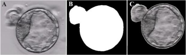 Figure 3 Blastocyst’s image extracted from TL video, A) raw image, B) image masking from U-NET model, C) segmented blastocysts image utilizing U-Net model