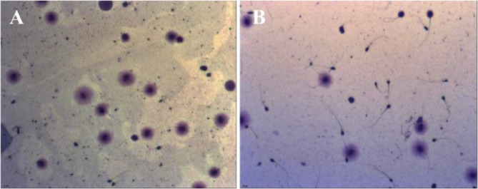 Figure 1 The effects of freezing at 20°C, as assessed by Halosperm technique, on DFI before cryopreservation (A) and after thawing (B)