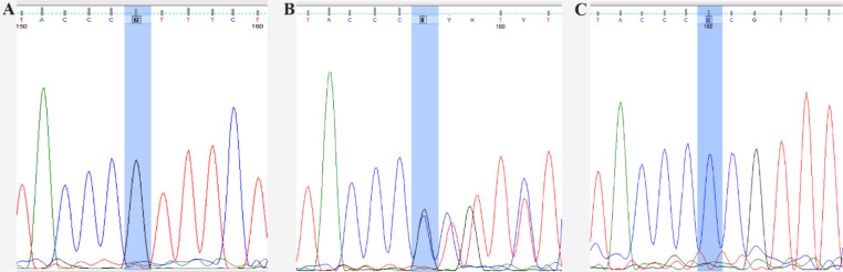 Figure 1 Sequence analysis chromatogram of wild-type (A), heterozygous (B), and del/del homozygous alleles (C) of DEFB126