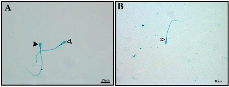 Figure 2. Spermac staining. Morphologies of sperm cells stained with spermac stain are shown. Cells with normal head morphology (black arrow) and cells with long head morphology (white arrow) in the OAS group are shown (A). Sperm cells belonging to t