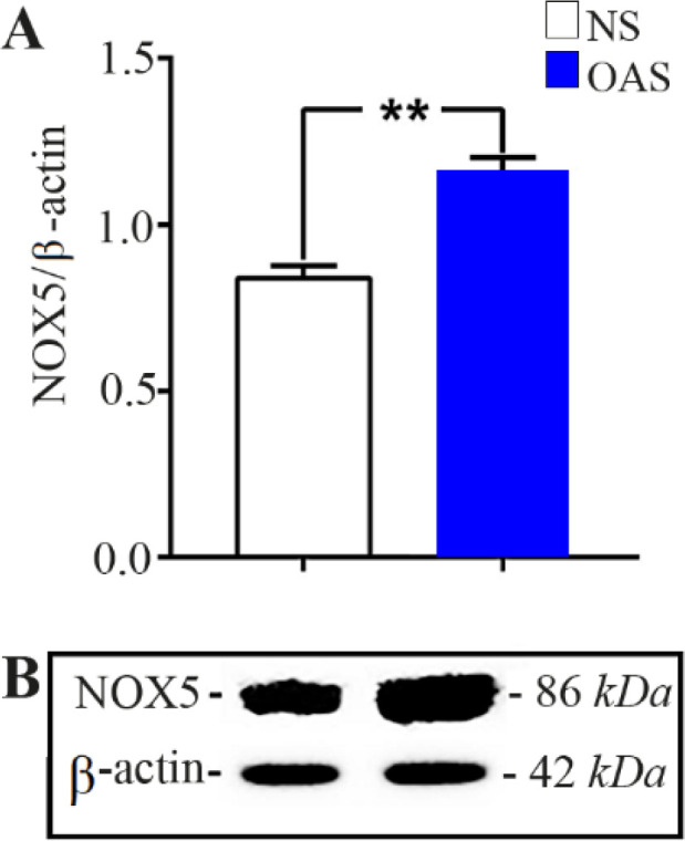 Figure 6. NOX5 protein expression level comparison between NS and OAS. A) NOX5 protein were significantly higher in OAS group. B) NOX5 protein. Values are mean ± standard deviation (**p<0.001)