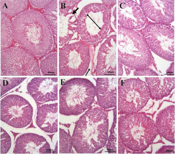 Figure 1. H&E-stained histology of testis showing (A) Sham group, (B) torsion/detorsion (T/D) group, (C) vitamin E group (20 mg/kg), (D) torsion/detorsion (T/D) group with a therapeutic dose of 300 mg/kg (T/D+Cit300), (E) torsion/detorsion (T/D)