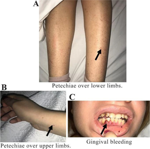 Figure 1 Clinical presentation of the patient