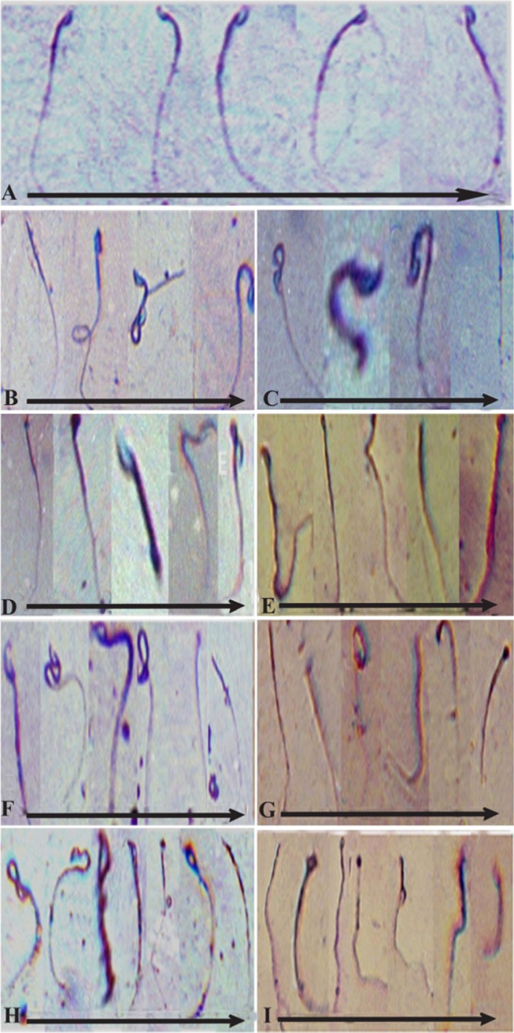 Figure 1 Normal morphological sperm forms in the controls (A) and morphologically abnormal sperms after GnRH-BSA and Kamdhenu ark along with GnRH-BSA administration (BI) in male Mus musculus.