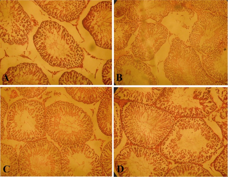 Figure 1 A: Normal Testis with orderly arrangement of germinal cells (Hematoxylin and eosin; staining; magnification x100), B: Disordered, sloughed germinal cells within the seminiferous tubules in the torsion/detorsion group (Hematoxylin and eosin s