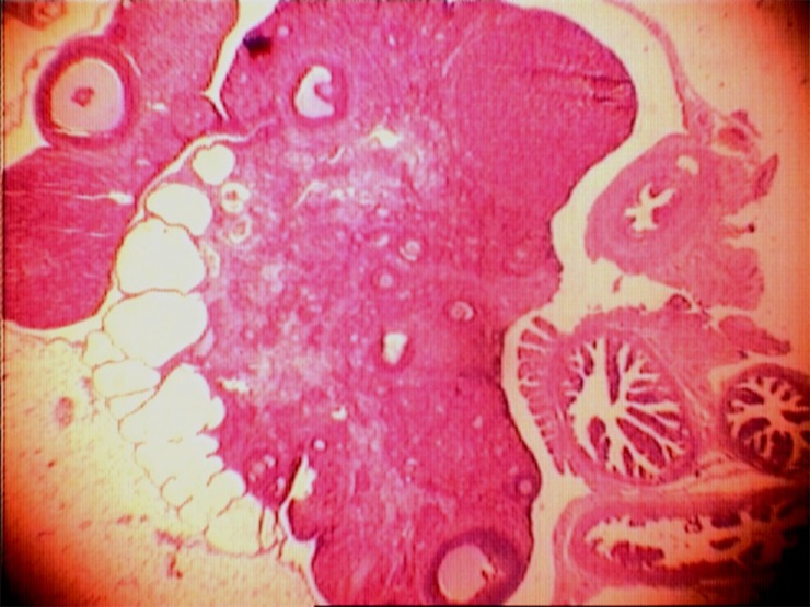 Figure 1 The ovary. In the ovarian tissue, the cysts were mainly appeared by a single intramuscular dose of estradiol valerate, 2 mg in 0.2 ml of corn oil