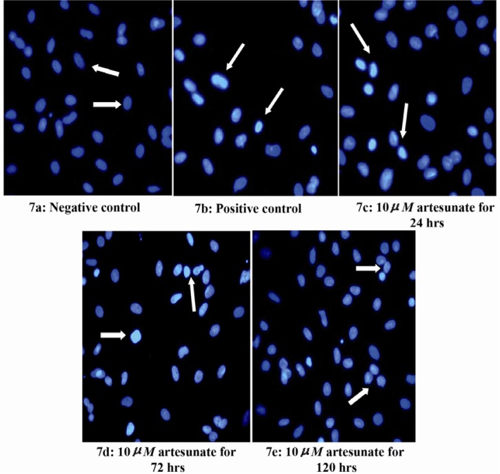 Figure 7 Effects of 10 μM artesunate on ds-DNA integrity of Sertoli cells. (7a) Negative control (untreated) (7b) Positive control (N-9 treated) (7c) 10 μM of artesunate for 24 hours (7d) 10 μM of artesunate for 72 hours (7e) 10 μM of artesunate for 