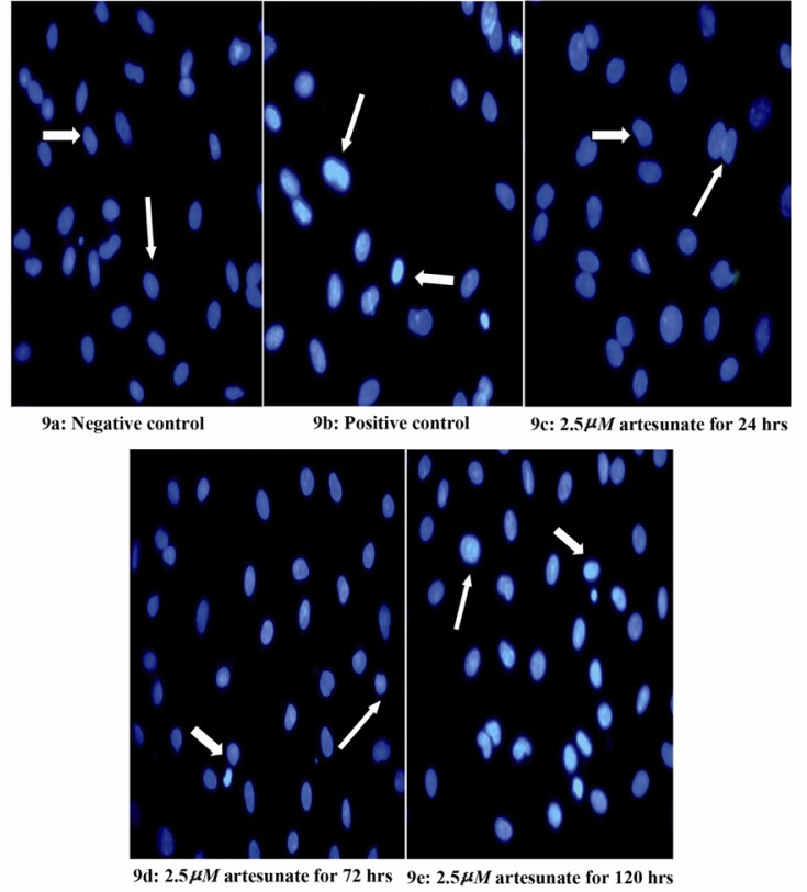Figure 9 Effects of 2.5 μM artesunate on ds-DNA integrity of Sertoli cells. (9a) Negative control (untreated) (9b) Positive control (N-9 treated) (9c) 2.5 μM of artesunate for 24 hours (9d) 2.5 μM of artesunate for 72 hours (9e) 2.5 μM of artesunate 