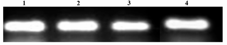 Figure 11 Transferrin gene expression in cultured Sertoli cells. 1=Artesunate (5 μM); 2=Artesunate (2.5 μM); 3= Artesunate (1.25 μM); 4=Control