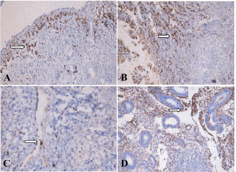 Figure 1 Immunostaining of apelin in eutopic and ectopic endometria. In eutopic and ectopic endometrial glands, apelin was expressed diffusely in the secretory phase and downregulated in the proliferative phase. Stromal staining intensity of apelin w