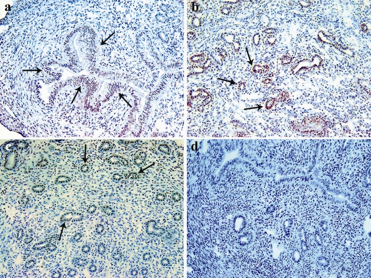 Figure 1 Immunohistochemical detection of IDO-positive cells in the endometrium of pregnant mice at different gestational periods. Uteri of syngeneic pregnant (Balb/c× Balb/c) mice were removed at early (a), mid (b) and late (c) gestational periods a