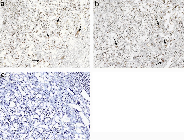 Figure 2 Localization of IDO in placenta of pregnant mice. At mid (a) and late (b) stages of syngeneic mouse pregnancy (Balb/c× Balb/c), placenta was immunostained by IDO-specific antibody. Fig.c: illustrates a representative nega-tive control slide.