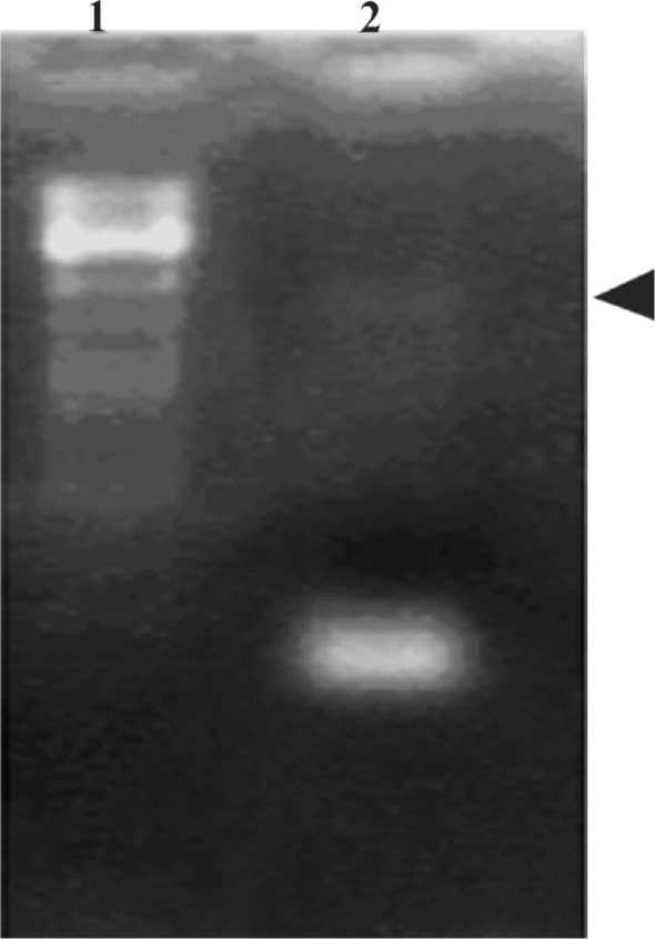 Figure 3 Amplification of PERF15 gene fragment. Samples of 50μl containing standard buffer, 200μM of each dNTP, 40pM of each primer, 100ng genomic DNA, 1.25unit of Taq DNA polymerase to 30 cycles of PCR amplification. Each sample was resolved on a 1%
