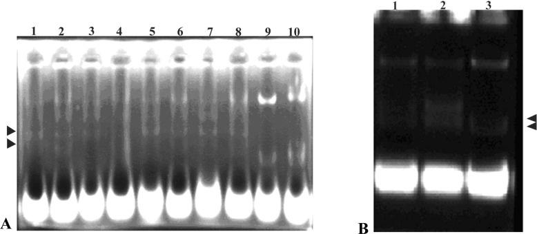 Figure 4 Restriction digest of amplified vector after the sub cloning of 3kb insert. A: Each plasmid was digested with NdeI restriction enzyme (lanes 1-8), undigested recombinant vector (lanes 9& 10), and the very upper band of each lane demonstr