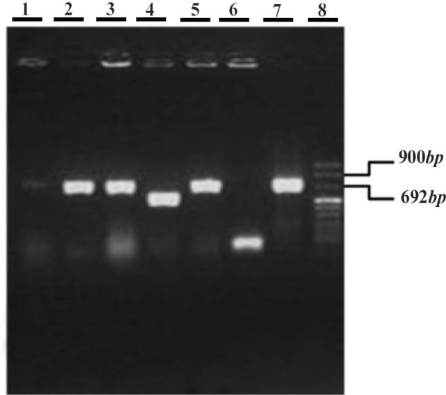 Figure 2 Coloy PCR on transformed JM109 clones by pGEM-T Easy vector carrying mTEX101 gene. 1-5: 5 selected white colonies, 6: negative control (blue colony), 7: positive control (PCR product on testis cDNA), 8: DNA ladder VIII (Roche).