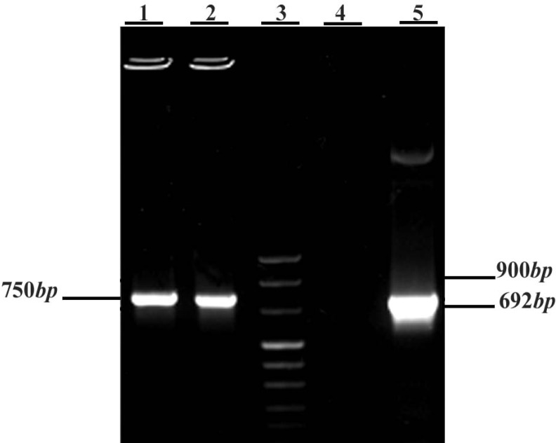 Figure 5 Colony PCR on transformed JM109 clones by pET-28a (+) vector containing mTEX101 fragment. 1 and 2 represent two selected colonies, 3: DNA ladder VIII, 4: negative control (no DNA), 5: positive control (pGEM-T Easy vector containing mTEX101 f