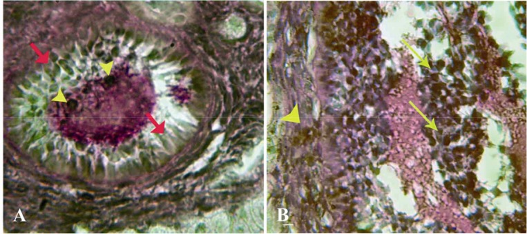 Figure 5 Cross-section from ovary 63 days after bilateral uterine artery ligation, A: granulosa cells (arrow) and the oocyte (arrow head) are presented with dense reaction for lipase enzyme; B: High magnification from granulosa cells and theca layer,