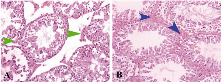 Figure 2 Photomicrographs of mice testis tissue in mice in the treated groups received methylphenidate; A: and the control group; B: Decrease in leydig cells and increase in the space between seminiferous tubules in the treated groups and comparison