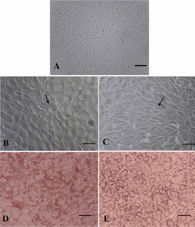 Figure 3 EnSCs differentiate into adipocytes. EnSCs before (A) and after differentiation into adipocytes at 12 days PT (B) and at 21 days PT (C), as demonstrated by light microscopy (A,B,C), Oil Red O staining to demonstrate lipid accumulation at 28