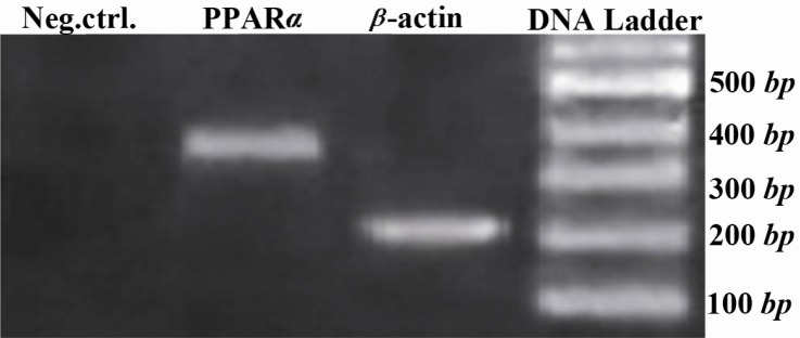 Figure 4 Adipocyte-related gene expression analysis of EnSCs 28 days PT using RT-PCR. β-actin was used as internal standard