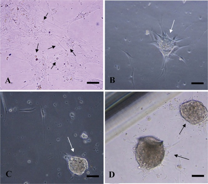 Figure 1 Spermatogonial Stem Cell (SSC) Clusters in vitro culture condition. A: cultured human testicular cells (arrows) before colony formation (7 days after digestion); B: Germ stem cell colonies (arrow) after 2 weeks; C and D: germ stem cell clust