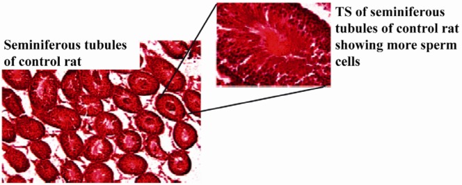 Figure 1 Transverse sections (TS) of the seminiferous tubules of control rats