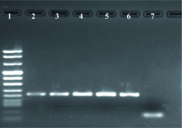 Figure 1 Detection of C. trachomatis from cervical swab specimens by PCR using orf8 primers. Lane 1, DNA size markers; Lane 2-5, positive patients for C. trachomatis; Lane 6, positive control; Lane 7, negative control