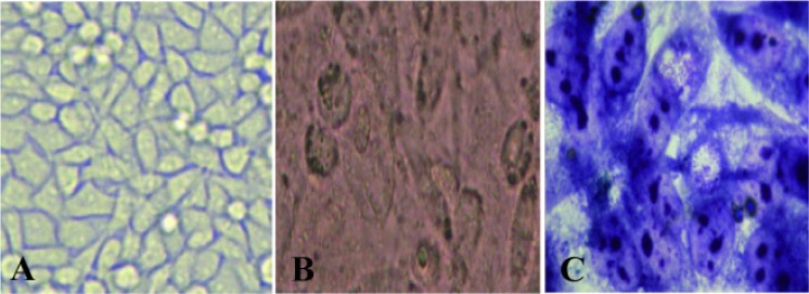 Figure 2 MacCoy cell line; A: before inoculation of specimen; B: after inoculation and C: after Gimsa staining