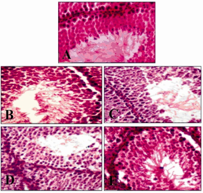Figure 2 Photomicrographs of stained histological slides of the testis after 45 days of treatment; A: Group I (Control), B: Group II (AMP 20 mg/kg), C: Group III (SASP 200 mg/kg), D: Group IV (Combination), E: Group V (Recovery)
