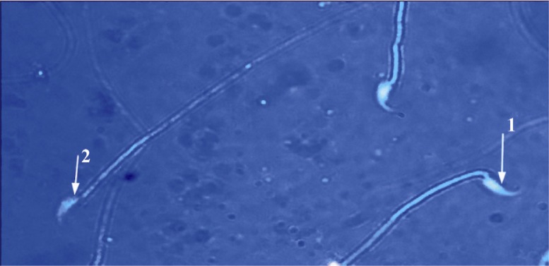 Figure 2 EP group: sperm head with mature nuclei is light blue; 1: and sperm head containing immature nuclear chromatin is dark blue; 2: (Aniline blue ×1000)