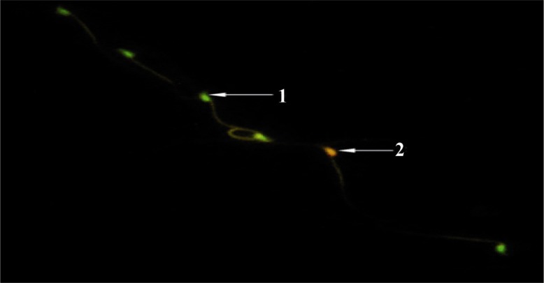 Figure 3 MTX+EP group: sperm with normal DNA integrity had green fluorescence, and those with diminished DNA integrity had orange-red staining (Acridine orange ×400)