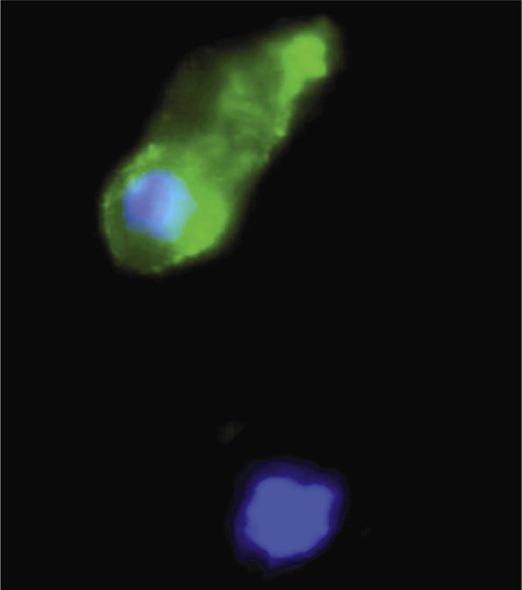 Figure 1 Cumulus cells positive (top) or negative (bottom) for Annexin V staining. DNA is stained with Hoescht 33342