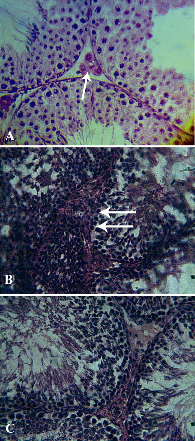 Figure 1 Seminiferous tubule epithelium stained with H&E and its morphology evaluated with light microscope. A: Seminiferous tubules in control group. Leydig cell illustrated with the arrow. In the control group, the seminiferous tubules cells we