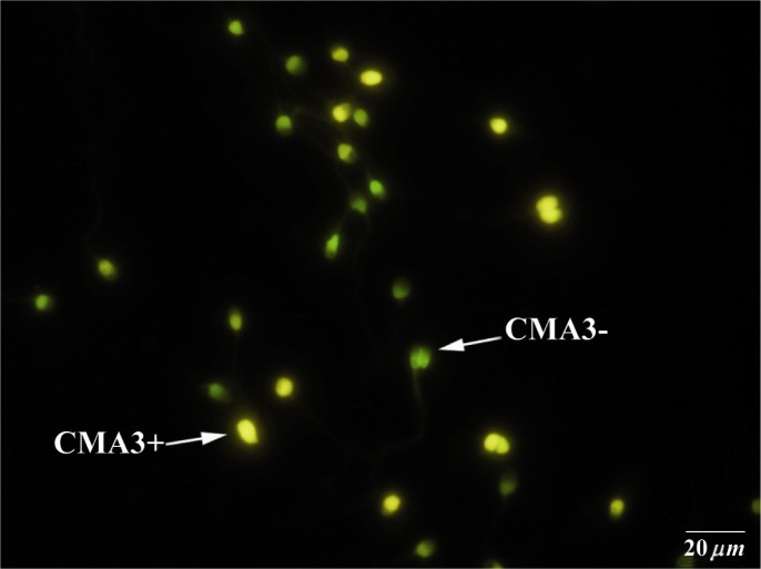 Figure 1 Chromomycin A3 (CMA3) staining: CMA3+ or protamine deficient spermatozoa appear as bright yellow, CMA3- or spermatozoa with normal protamine appear yellowish green