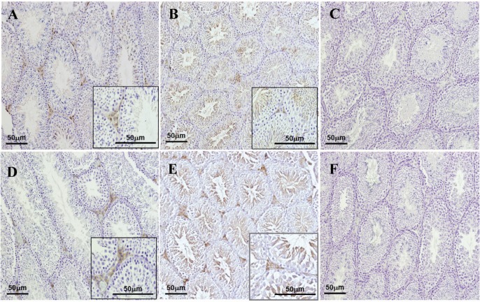 Figure 6 Immunohistochemistry reveals the absence of FGFR1 (A) and FGFR2 (D) in spermatogonia, spermatocytes and spermatids of Tex101-iCre;Fgfr1flox/flox (A) and Tex101-iCre;Fgfr2flox/flox (D) adult mice, while immunostaining of FGFR1 (A) and FGFR2 (