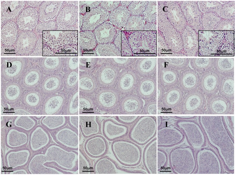 Figure 7 Morphological analyses of H & E stained sections of the testes; A-C: and caput D-F: and cauda G-I: epididymis do not show any abnormalities in either Tex101-iCre;Fgfr1flox/flox (A, D & G) or Tex101-iCre;Fgfr2flox/flox (B, E & H)