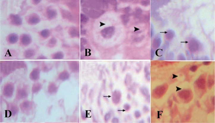 Figure 1 Morphological changes in the testis of different groups. Ethanol consumption induced an increase in glygogen droplet and vacuolization of testis tissue. Vitamin E treatment along ethanol consumption alleviated the structure changes. A: contr