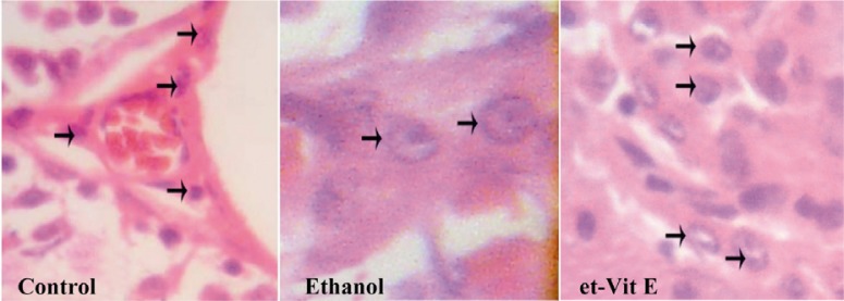 Figure 2 Photomicrograph showing the density of Leydig cells in different groups () Leydig cells (Magnification ×400)