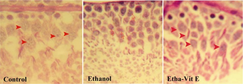 Figure 3 Histophatology of testis tissue in control, ethanol rats, and ethanol-vitamin E rats (hematoxylin-eosin, original magnification×400). (Control) Control testis tissue with normal genocytes location undergoing mitosis division. (Ethanol) ethan