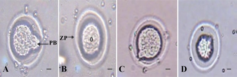 Figure 2 Image of oocytes in treated groups. A: Sham; B: Control; C: LDE; D: HDE. O: Oocyte; ZP: Zona Pellucida; PB: Polar Body. Scale bars= 10 µm