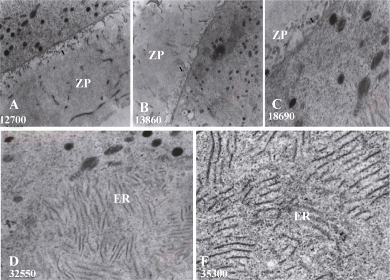 Figure 5 Photomicrograph of ultra-thin sections of oocytes and the zona pllucida in A: Control; B: LDE; C: HDE treated groups. High magnification of oocytes’ cytoplasm in control (D) and HDE treated groups (E). Uranyl acetate and lead citrate stainin